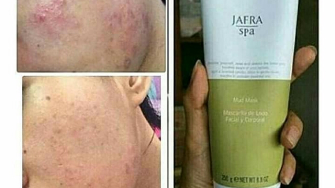 Toko Skincare (1) terbaik di Kota Bandar Lampung